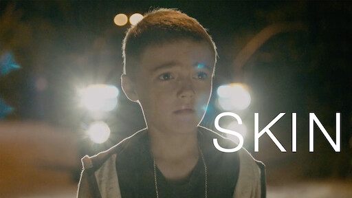 Watch Skin (Short Film) | Netflix
